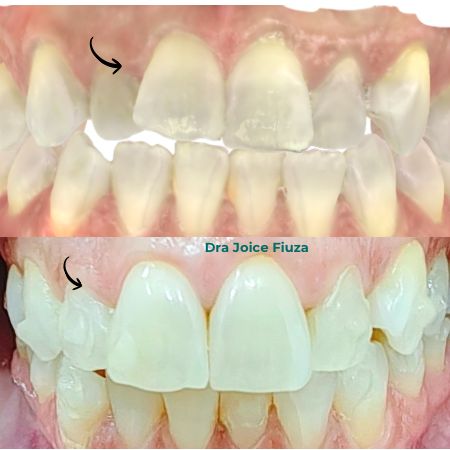 Caso real: antes e depois