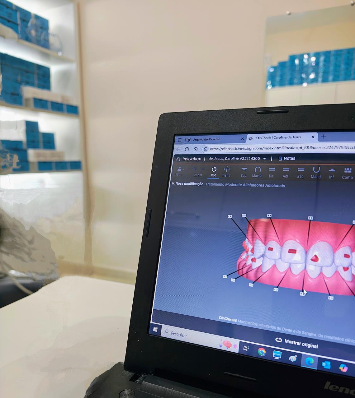 Planejamento digital do tratamento Invisalign