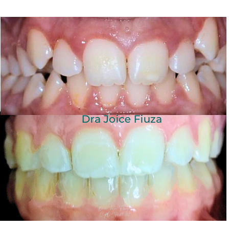 Caso real: antes e depois