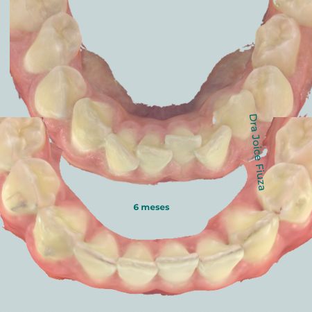 Caso real: antes e depois