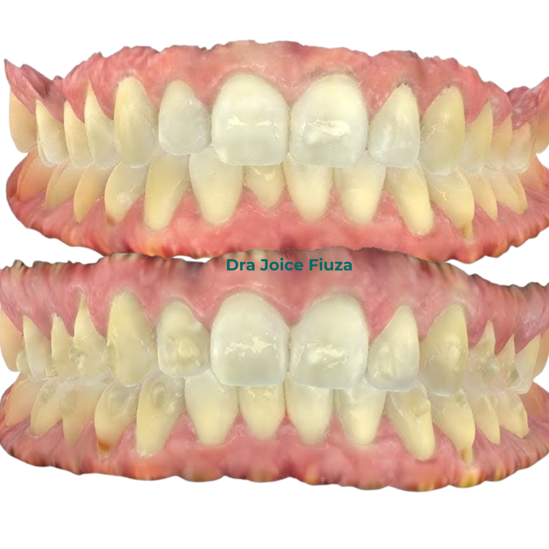 Caso real: antes e depois