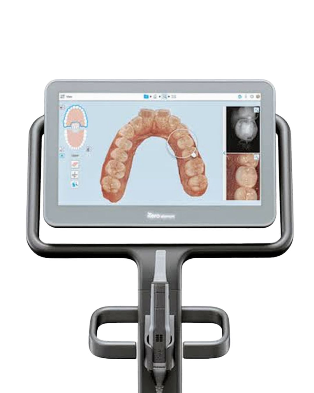 Scanner intraoral iTero com imagem digital dos dentes
