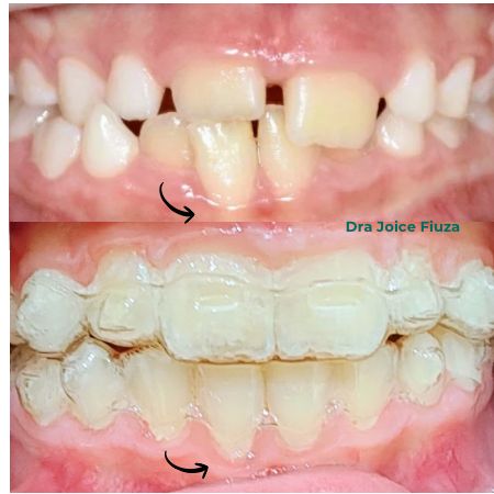 Caso real: antes e depois