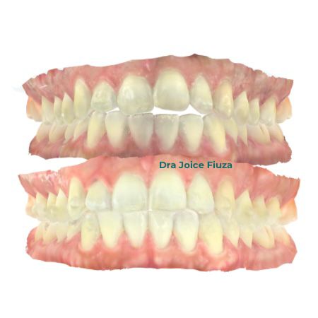 Caso real: antes e depois